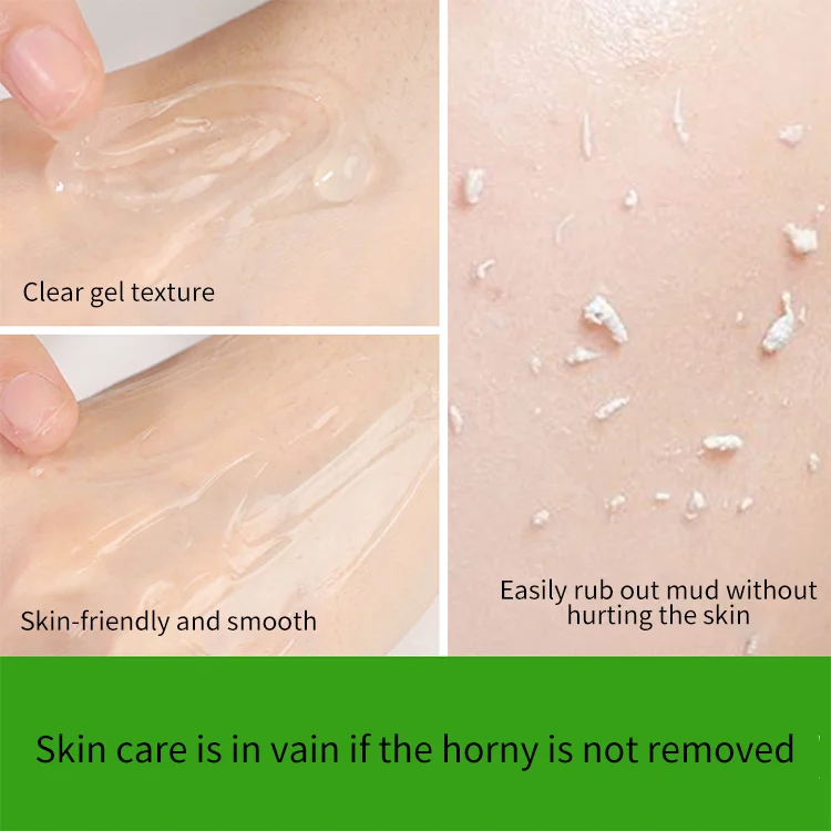 Oem Wholesale Fructic acid Exfoliating Gel Natural Hydrating Gentle Repair Skin Facial Gel