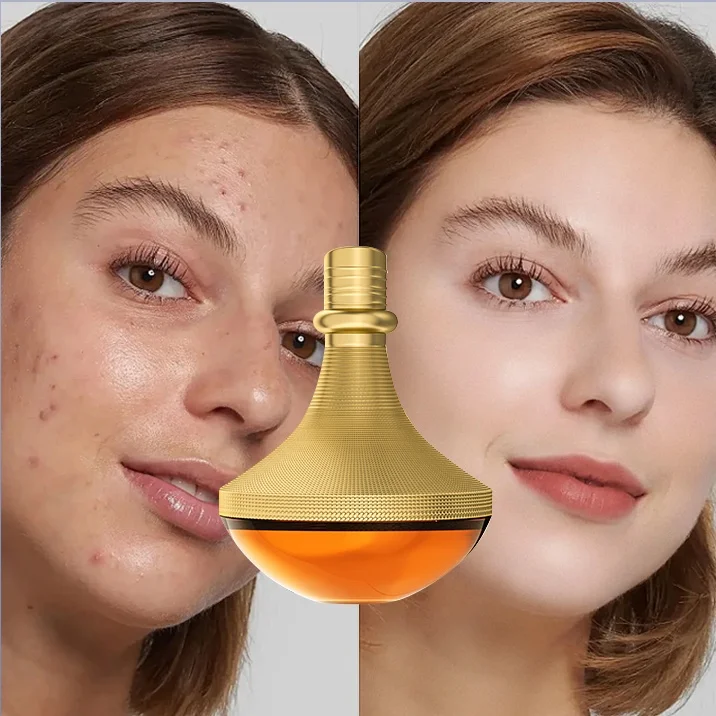 Peptide 6 in 1 Strong Removal Dark Spot Corrector Skin Care Ecdoine Whitening anti wrinkle Freckle Moisturizing Face Cream