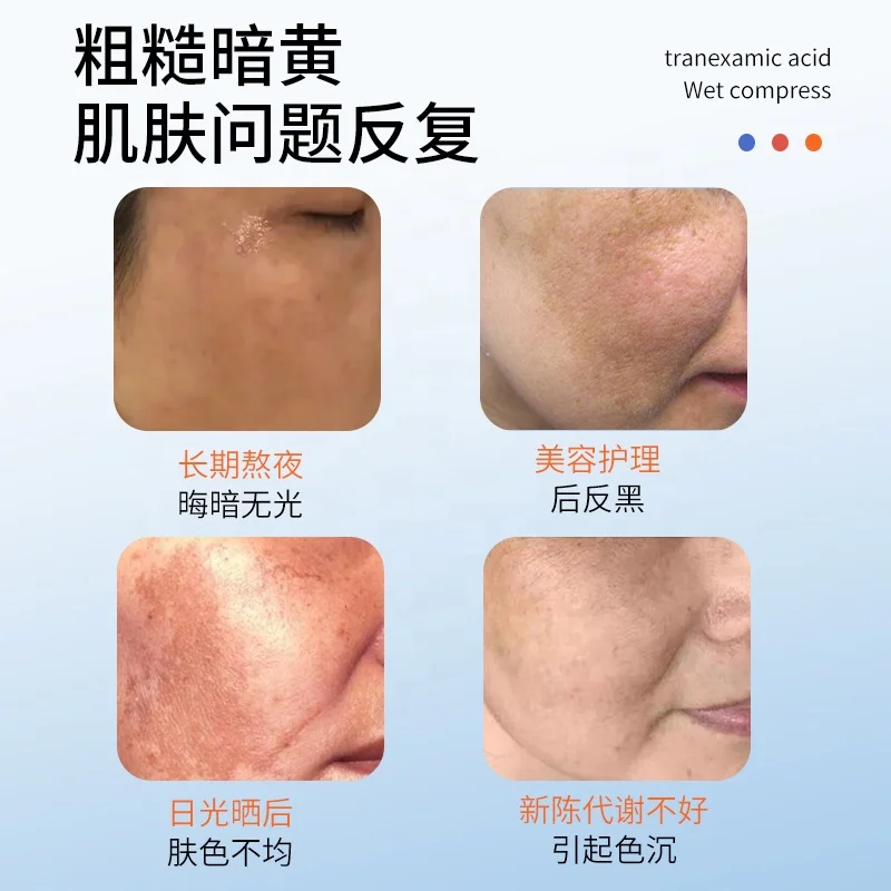 Guangzhou Skin Care Manufacturer OEM ODM Lightens Spots Anti-Darkness And Antioxidant 5%  Tranexamic Acid Wet Compress Liquid