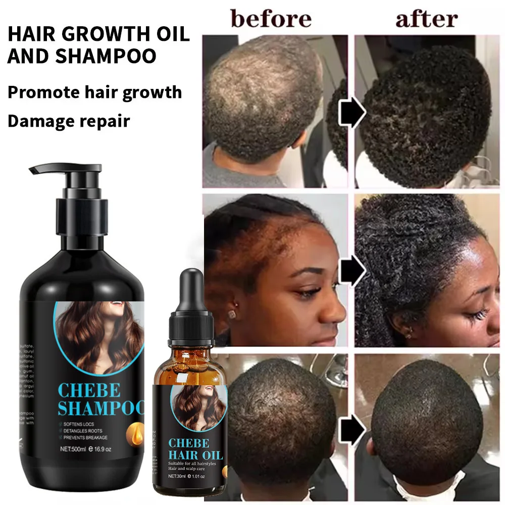 Private Label Shampoo CHEBE Powder Anti-dandruff Anti Hair Loss Conditioner Hair Food Moisturizing Essence Women Products Kit