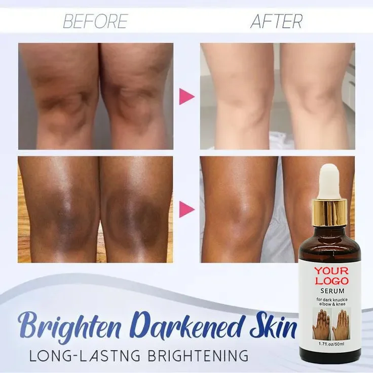 Best Selling Knee Elbow Dark Knuckle Removal Serum Strong Effective Knee Bleaching Whitening Serum for Skin Lightening