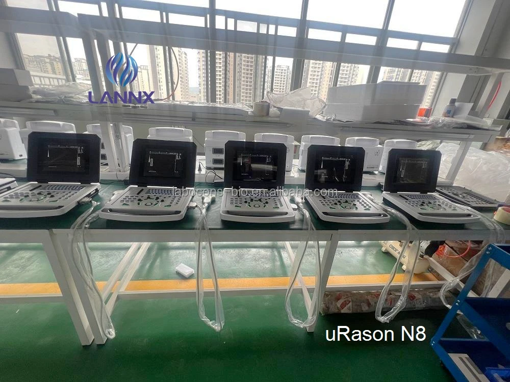 LANNX uRason N8 Factory price B/W Portable Ultrasound Machine Digital Ultrasonic Diagnostic Imaging System Doppler Ultrasound
