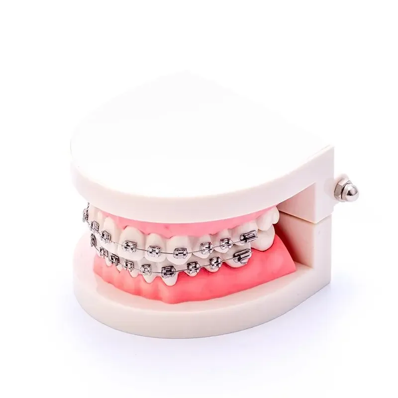 Модель зубных зубов стандартная обучающая модель с металлическим кронштейном для ортодонтического обучения
