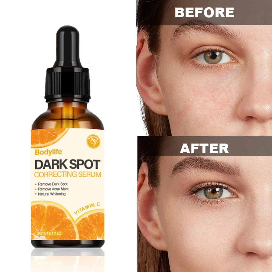 Natural Organic Vitamine C Skin Care Anti Aging Moisturizing Vitamin C Serum For Whitening And Glow dark spot removal serum