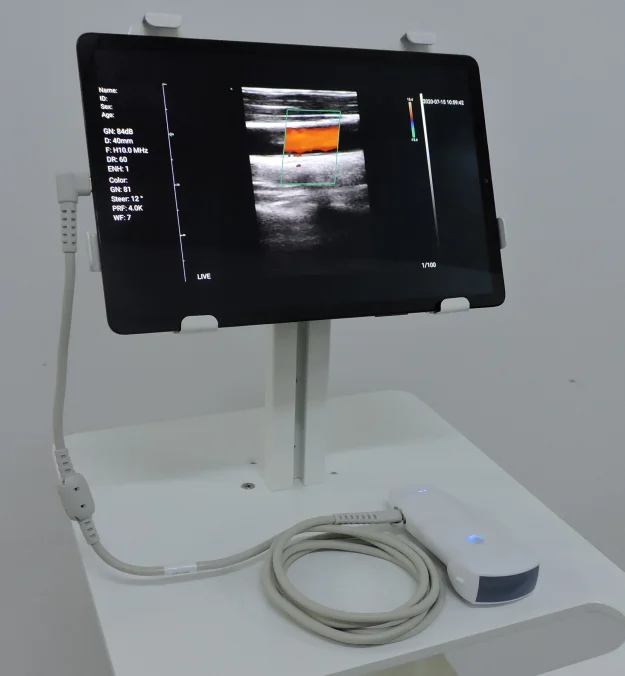 Handheld ultrasound machine price portable color doppler phone wireless 3.5/5.0 mhz ultrasound scanner