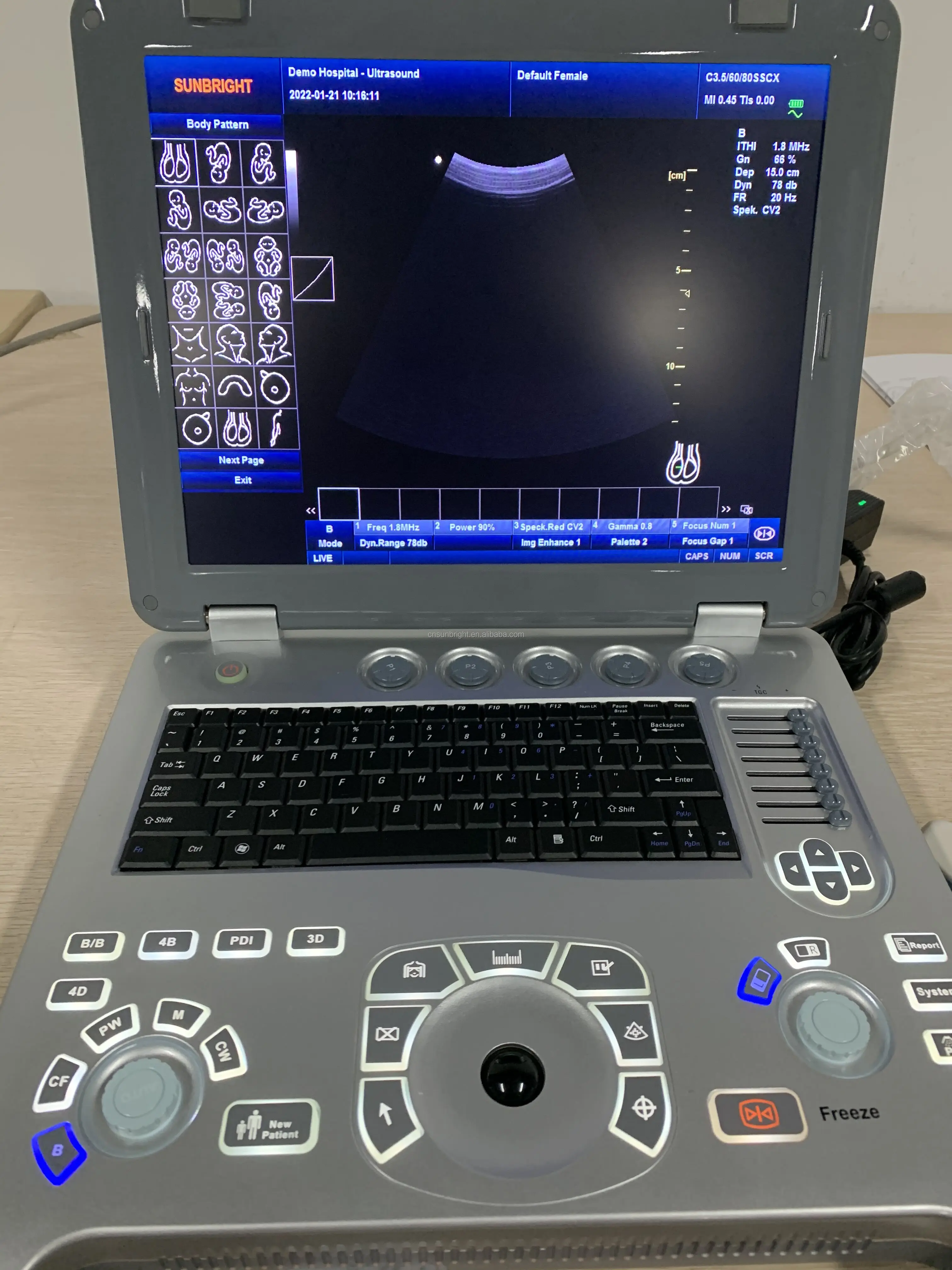 Color doppler ultrasound SUN-906B full digital ultrasound machine laptop obgyn ultrasound 3d