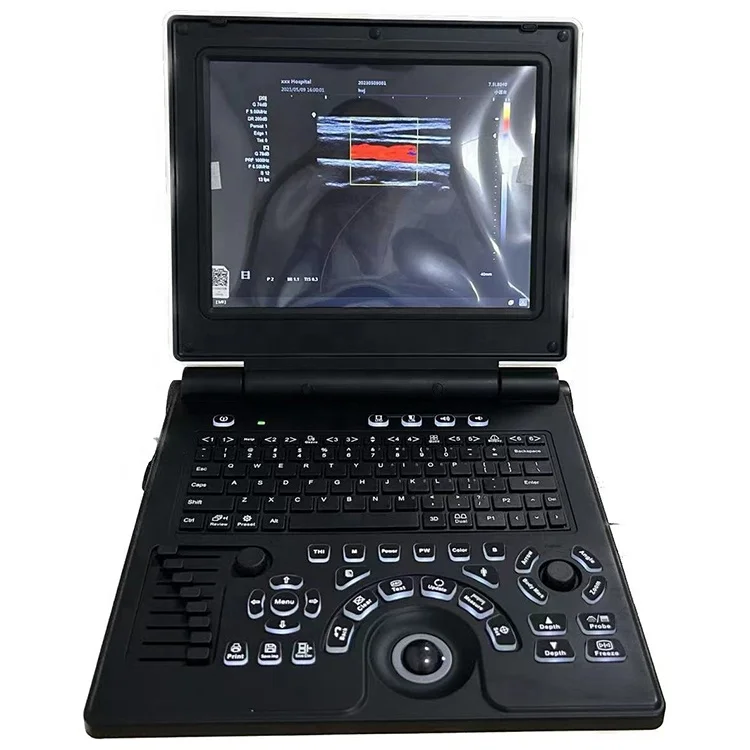 High Quality Medical Imaging Digital High Resolution Color Doppler 3D 4D Ultrasonic Portable Color Doppler Ultrasound