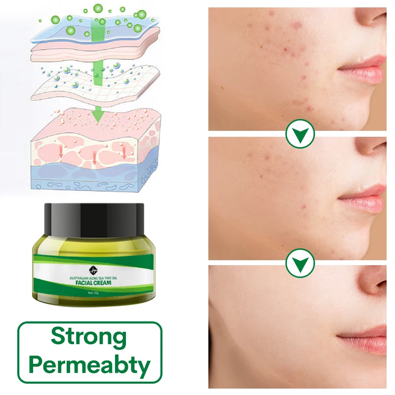 Private Label Organic Natural TEA TREE FACE SERUM For Skin Repair MoisturizingAustralian tea tree loofah essential oil soap