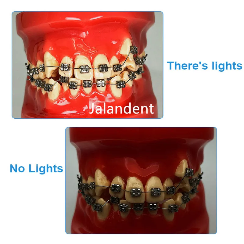 Handheld Dental Oral Photography Light for Mobile Phone Dental Led Filling Light With Bluetooth