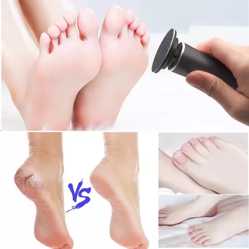 Hot Selling Foot Grinder Machine Electric Callus Remover Feet Care Foot File for Dead Hard Cracked Dry Skin remover machine