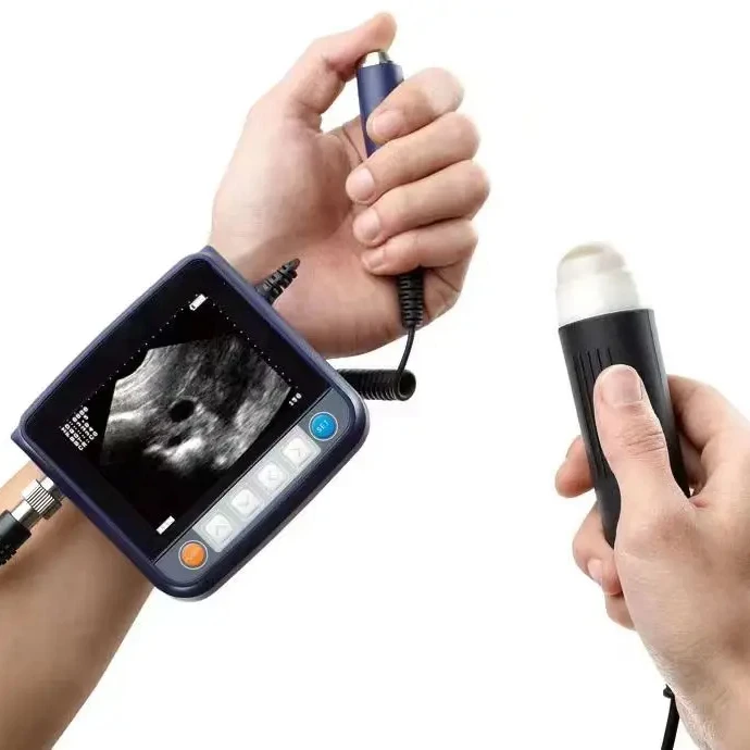 Hospital Bedside Ultrasound Scanner Monitoring Veterinary Health Parameters