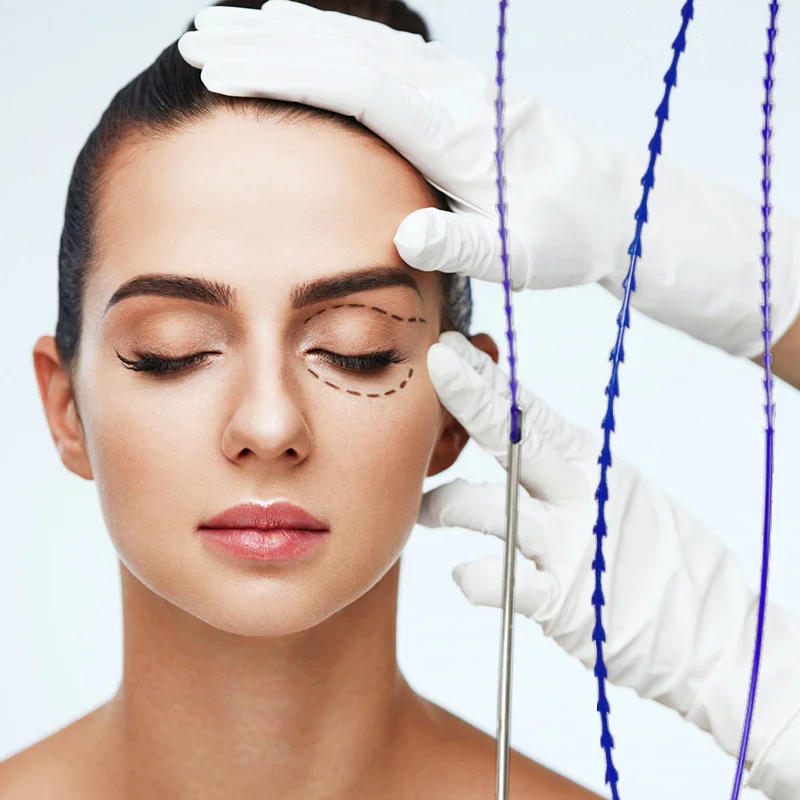 Face V Lift Eyebrow Lifting Cog Thread Medical Improves Wrinkle Eye Wrinkle Filler Skin Firming PDO Fishbone Thread