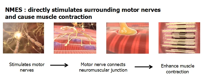 Hot Sell  Wireless Electro-therapy Device Eletromagnetic Muscle Stimulator TENS NMES