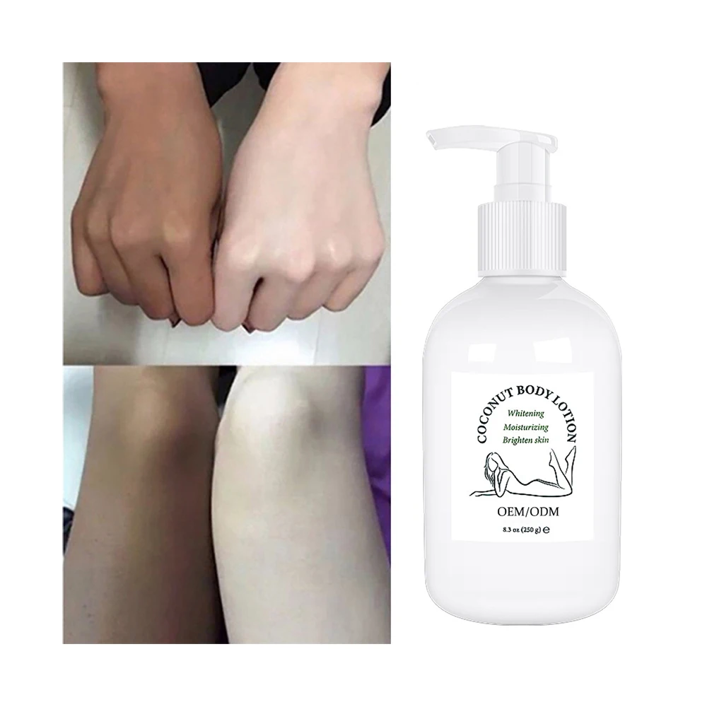 Кокосовое масло отбеливающий увлажняющий коллаген Гиалуроновая кислота Удаление меланина Уход за кожей лосьон для тела