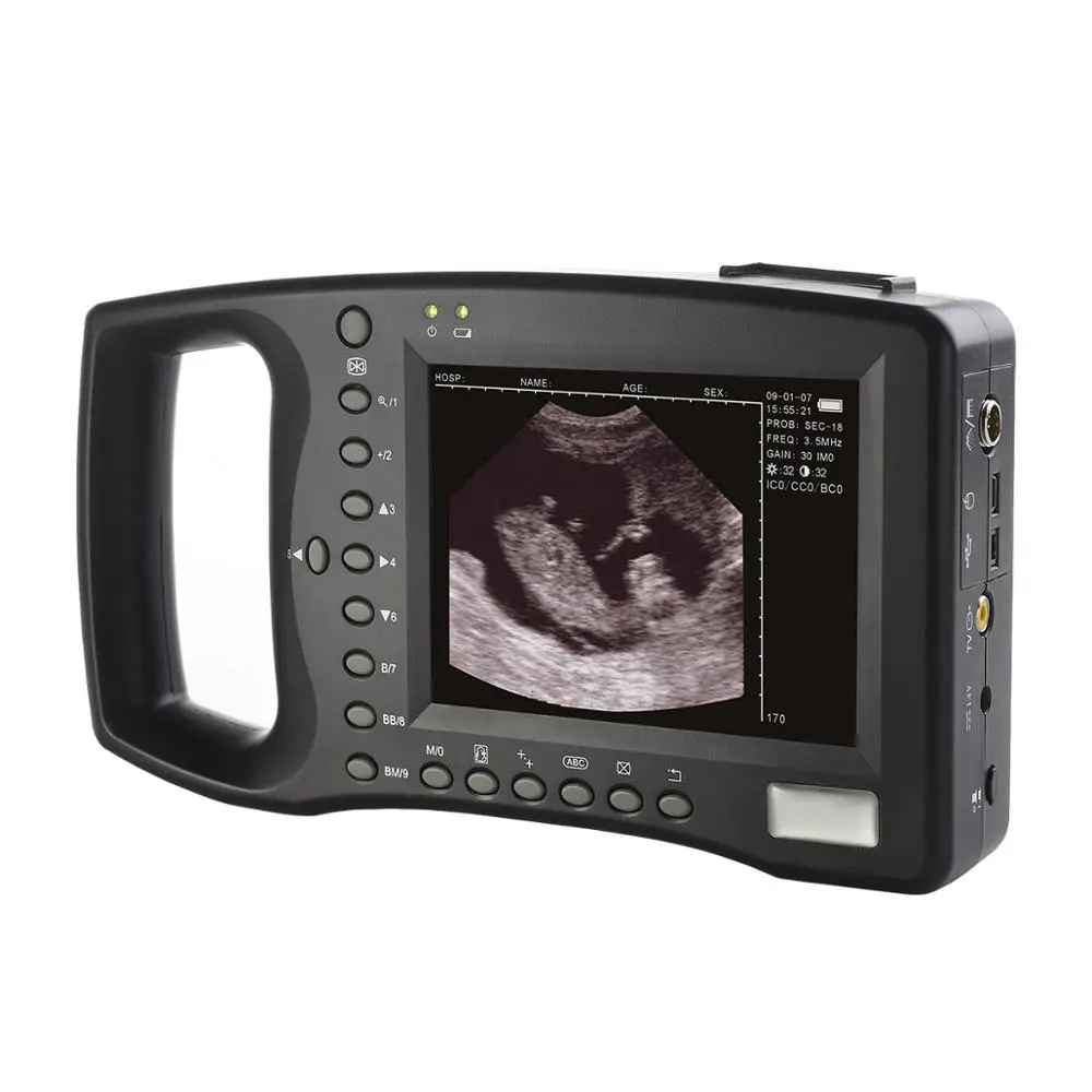 
KBW-2000V Palm Ultrasound Scanner(ultrasonicblack whiteImaging System) Vet ultrasound 