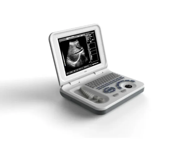 Portable Black and White Ultrasound Best Price China Medical Ultrasound Scanner portable ultrasound price