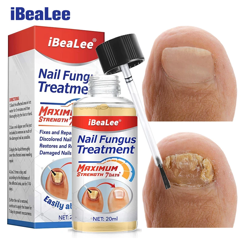 iBeaLee Nail Fungus Treatment 7DAYS Repair Essence Serum Hand Care Nails Foot Fungal Removal Cream Anti-infective Onychomycosis