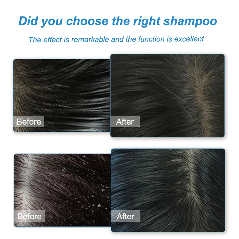 Oil control clean dirt fast effect delicate nourish soft and smooth help care scalp hair care growth shampoo thicker