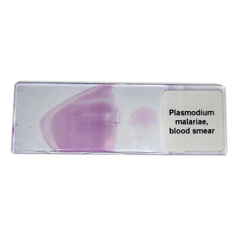 1 Piece Plasmodium malariae blood smear prepared slides for Parasitology Slides Sale
