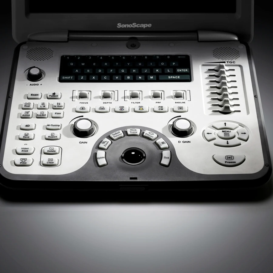 Good Quality Veterinary Portable Color Doppler Ultrasound Machine Sonoscape