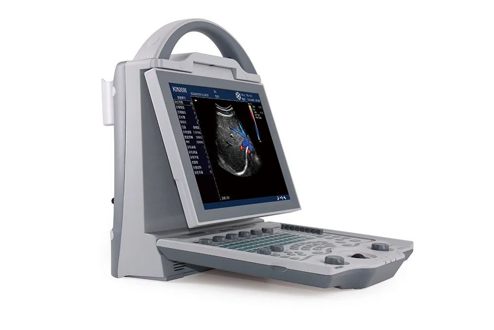 Hacemey animal veterinary ultrasound machine portable lcd screen vet color doppler ultrasound scanner for veterinarian