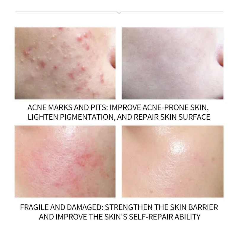 Firming Anti Wrinkle Skin Face Repairing GHK-Cu Blue Copper Peptide lyophilized powder