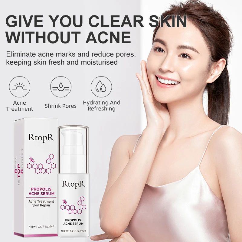 RtopR Propolis Repair Acne Brightening Serum Acne Scar Spots Cleaning Serum Shrink Pores Eliminates Acne Treatment Oil control