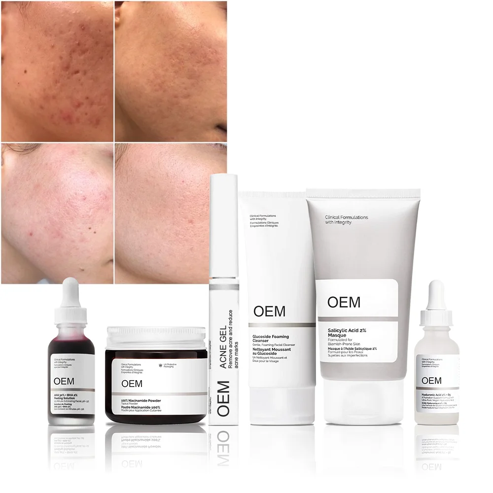 Ordinary Azelaic Acid 10% Gel Moisturizing Facial Cleanser For Acne Treatment Face-Cream Anti-Aging Wrinkles Repair Skin Care