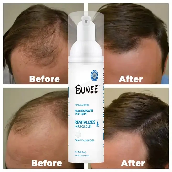 60ml private label Topical solution Collagen biotin bald hair growth oil foam