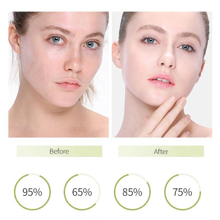 Factory Wholesale Hydrating Foaming Facial Cleanser Anti Wrinkle Acne Treatment  Deep Cleansing Face Wash