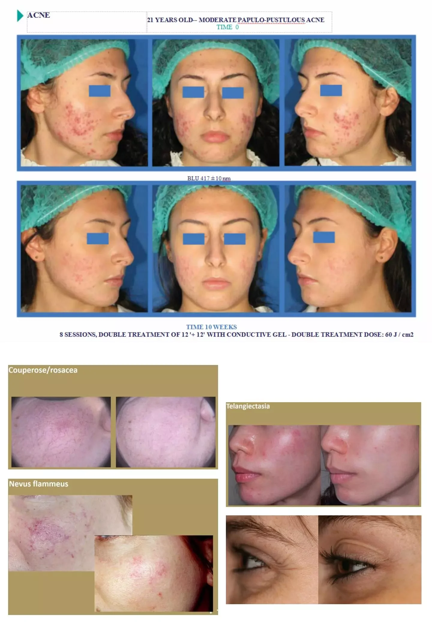 Medical CE Aesthetic Med Spa Salon use Device esthetician supplies red light therapy device