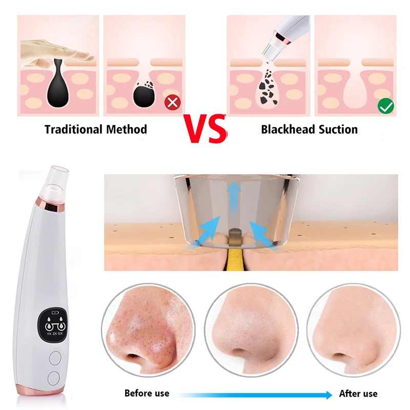 Electric Skin Care Appliance Facial Nose Cleaning Black Head Peel Removal Pore Cleaner Vacuum Comedo Suction Blackhead Remover