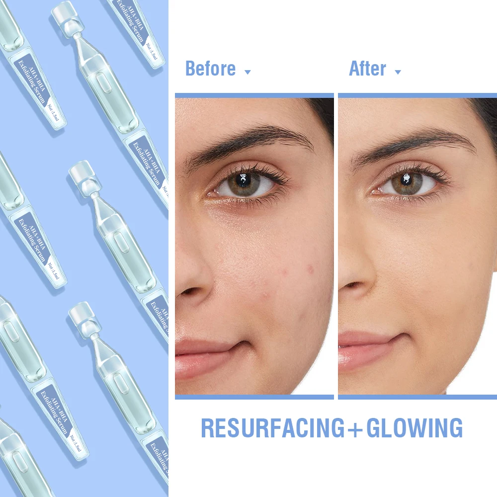 OEM ODM Custom Glycolic Salicylic Mandelic Acid Anti Acne Treatment Oil Control Repairing Skin Care Serum Ampoules