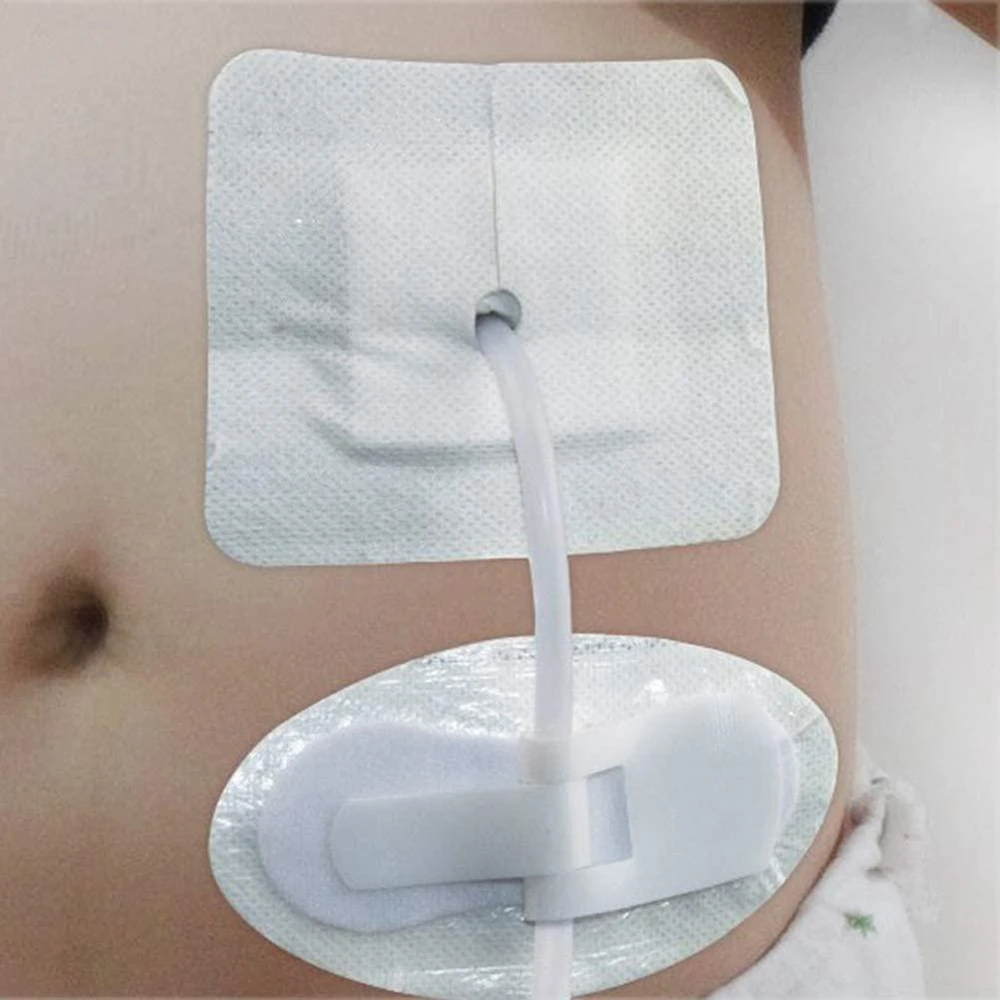 Мешок для мочевого катетера