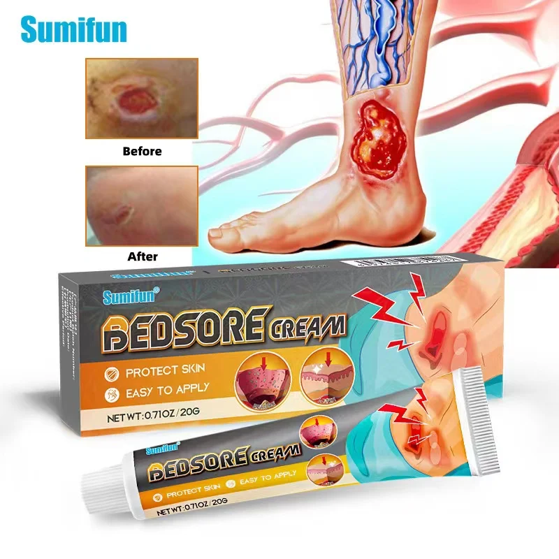 Best Seller Bedsore Treatment Cream Removal Rot Myogenic Pressure Sores Ointment Wound Healing Anti-infection Cream