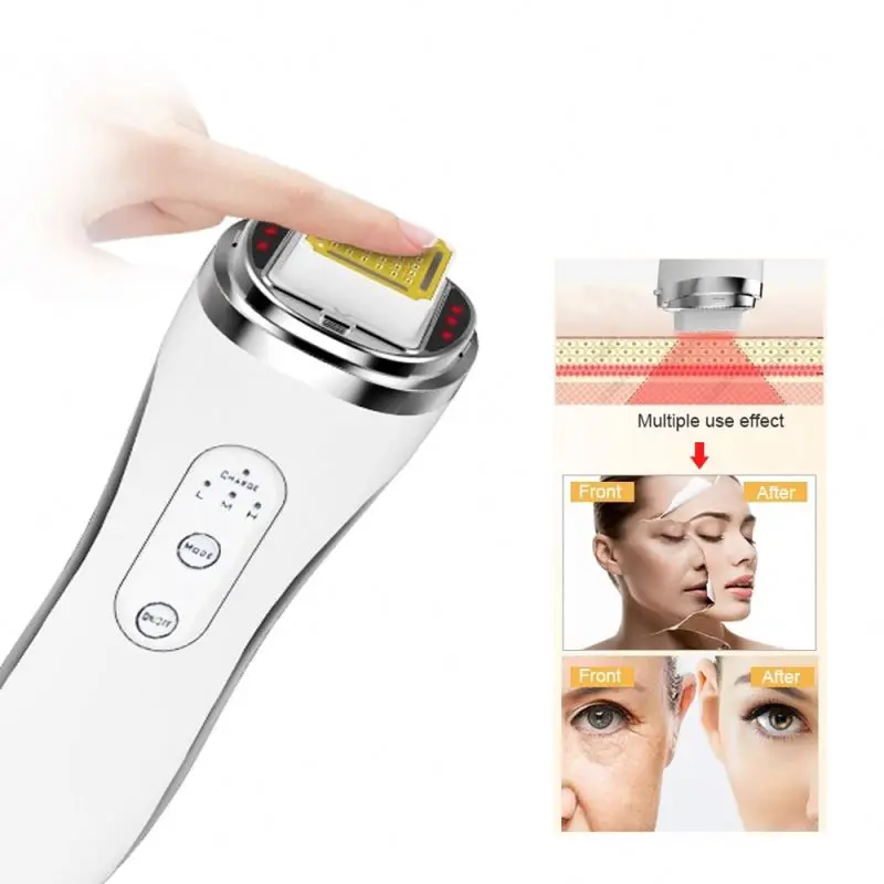 Home RF Anti Wrinkle Portable Face Massage Lifting Machine Beauty Equipment Radio Frequency For Skin Tightening RF EMS Vibration