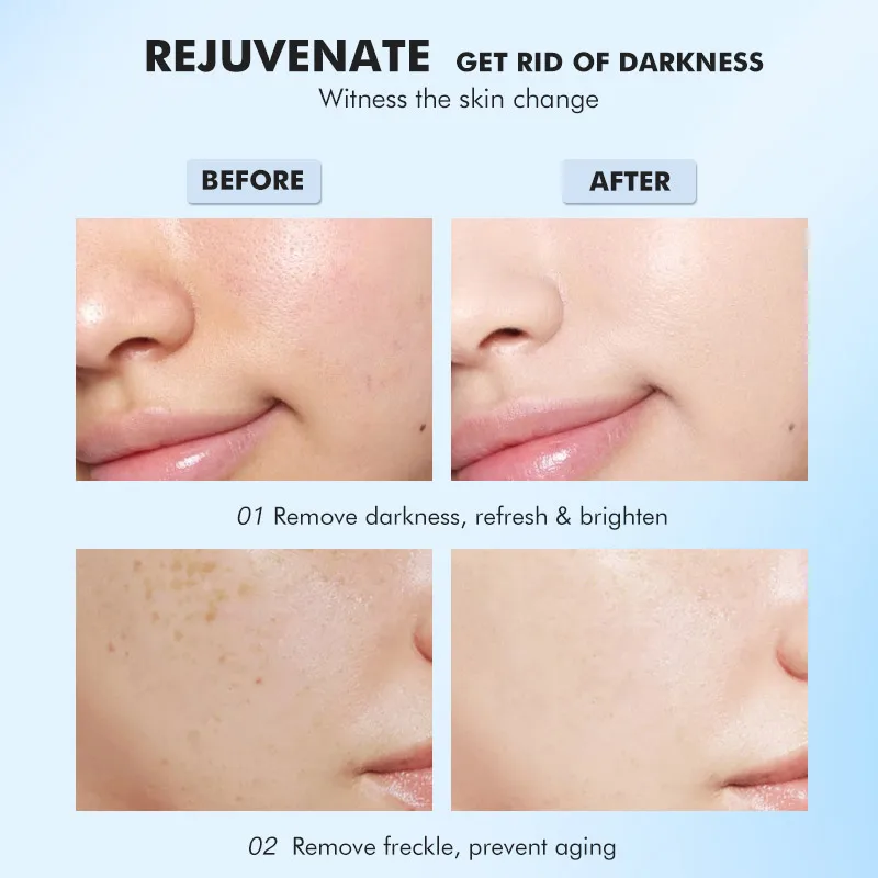 Led light beauty device led RF mini face beauty machine acne removal led beauty machine 5 lights therapy device for face