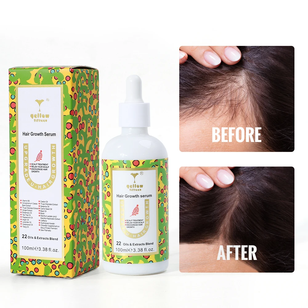 Private Logo Biotin Hair Growth Serum Regrowth Treatment for Scalp Loss Hair Thinning Natural Hair Growth