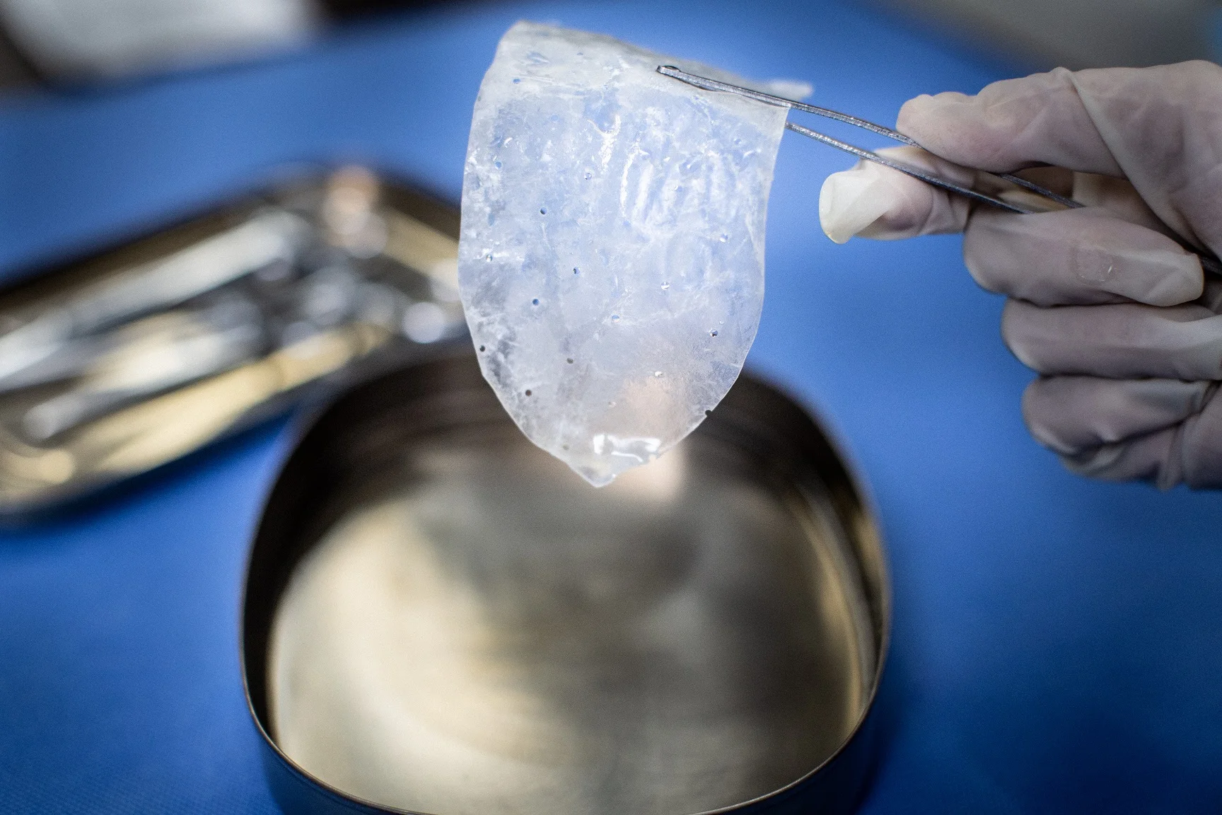 New SIS absorbable mesh surgical mesh for ventral incisional hernia repairs surgery instrument