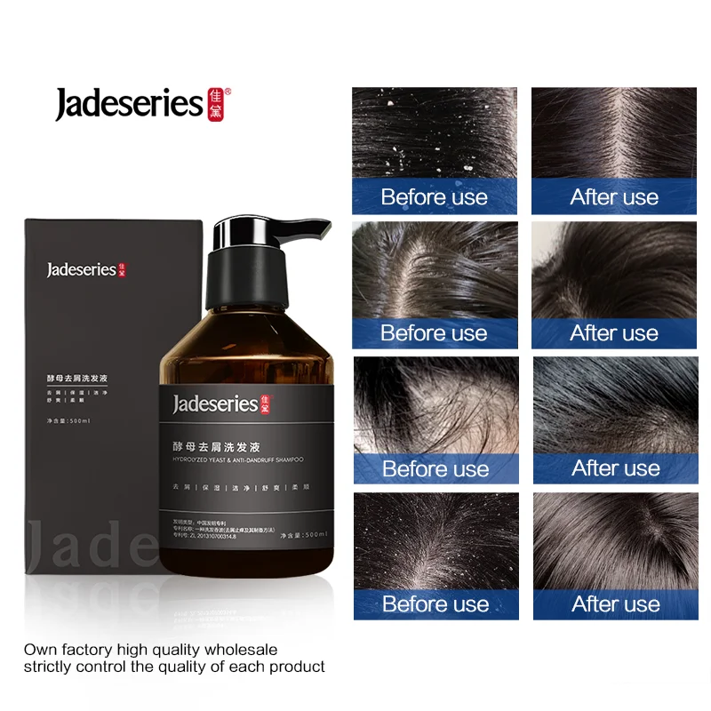 OEM/ODM custom spot natural organic private label shampoo wholesale price high quality anti-dandruff shampoo