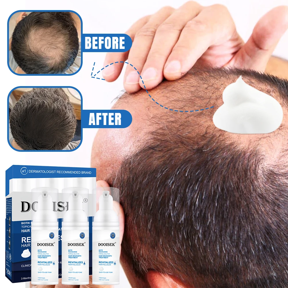 Hot Products 60ml Super Fast Hair Growth Serum Tonic 5% Hair Growth foam Anti Hair Loss Treatment