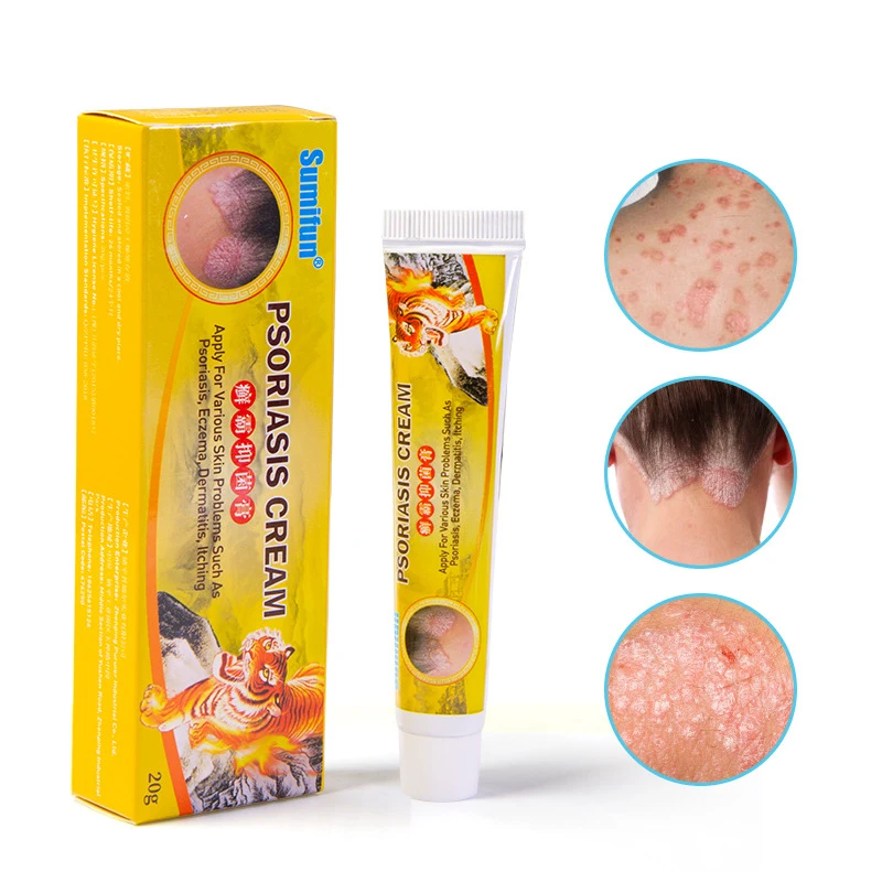 20g Herbal Antibacterial Cream Psoriasis Cream Wholesale Anti-itch Relief Eczema Skin Rash Urticaria Desquamation Treatment