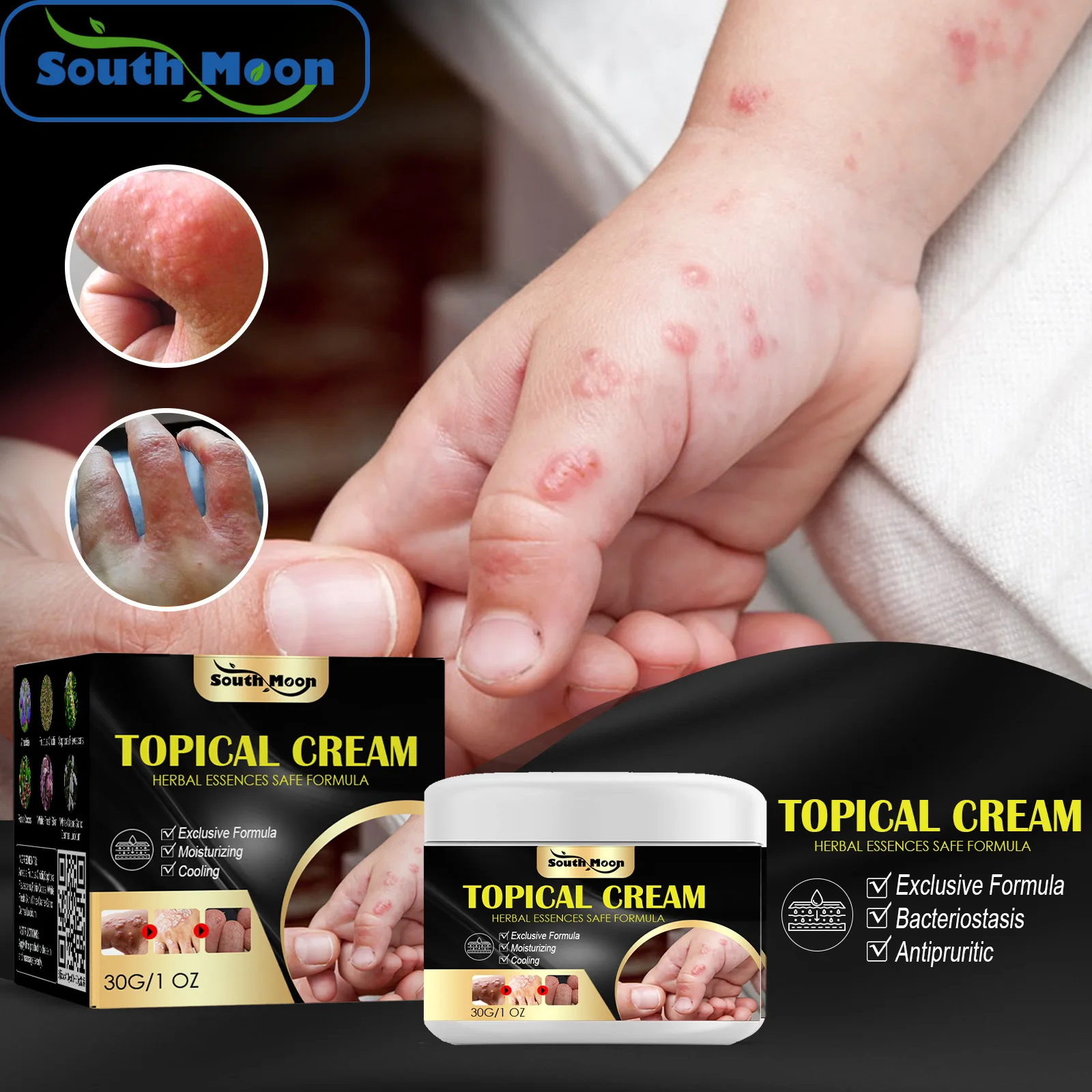 Topical cream sweat blister mosquito bite dry itching skin repairing hand foot antipruritic