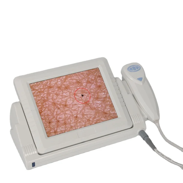 J015(CE) professional skin analyzer for hair and skin iris microscope