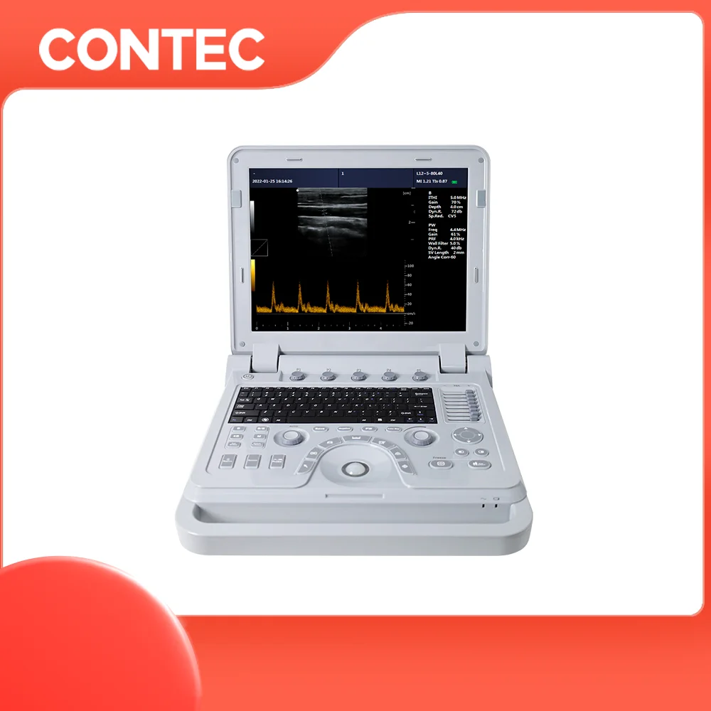 CONTEC CMS1700B Акушерская Урология живота кардиопедическая гинекология периферическая сосудистая диагностика Цветной Допплер