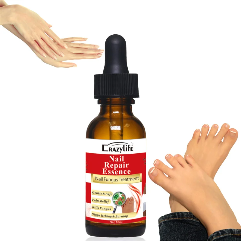 OEM 30ML Nail Fungal Treatment Feet Care Essence Nail Foot Toe Nail Fungus Removal Gel Anti Infection Paronychia Onychomycosis