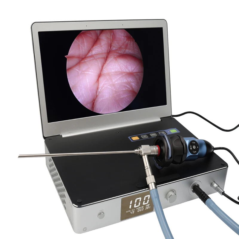 Hot sales endoscope camera endoscopic camera color laparoscopy