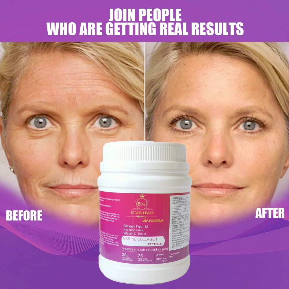 500g 1000g anti wrinkle anti aging collagen drinking powder skin care nail collagen powder with hyaluronic acid and vitamin c