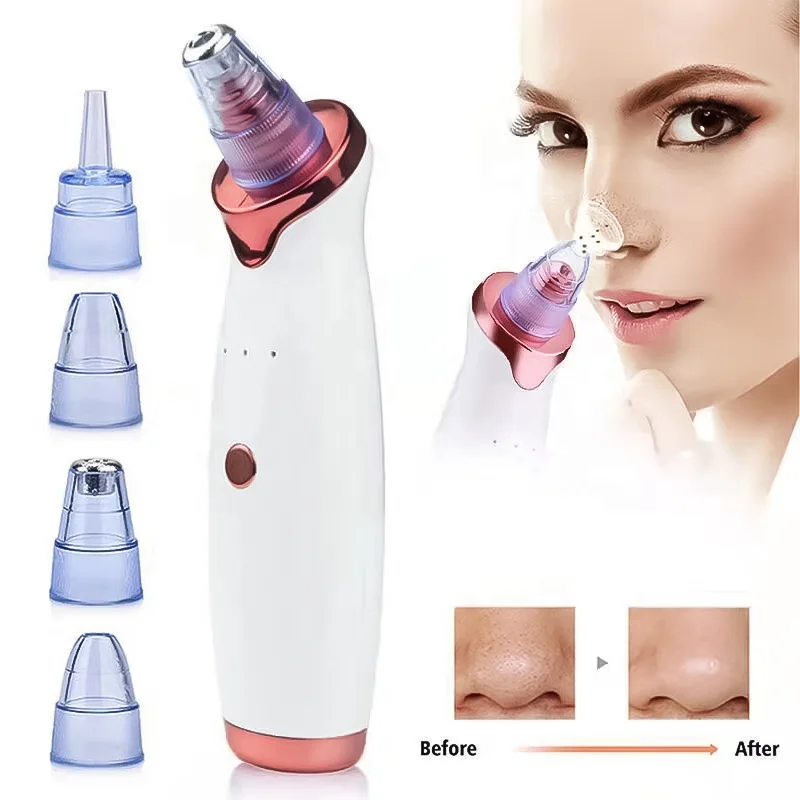 free sample blackhead removal vacuum with heat and cold blackheads remover needles pimple and blackhead remover
