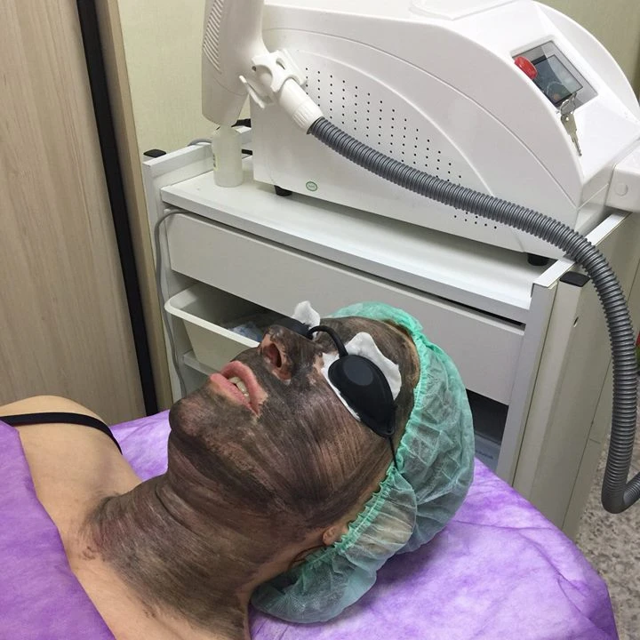 Portable Monaliza 1320nm Black Doll Q Switch Laser Eyebrow removal Laser Nd Yag Laser on Sale